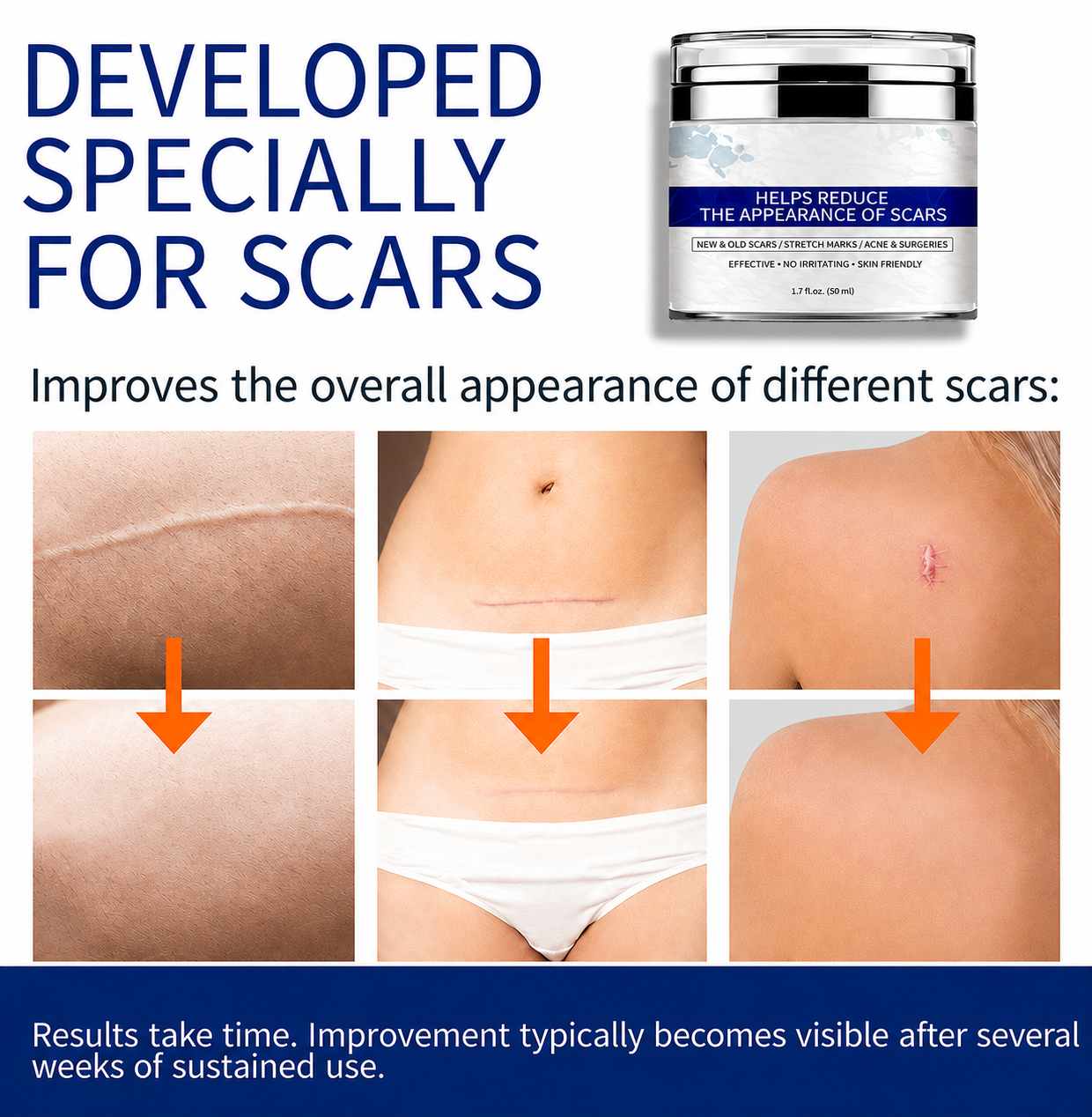 2026 NEW Repair & Fade Scar Cream